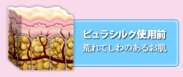 skin1-1